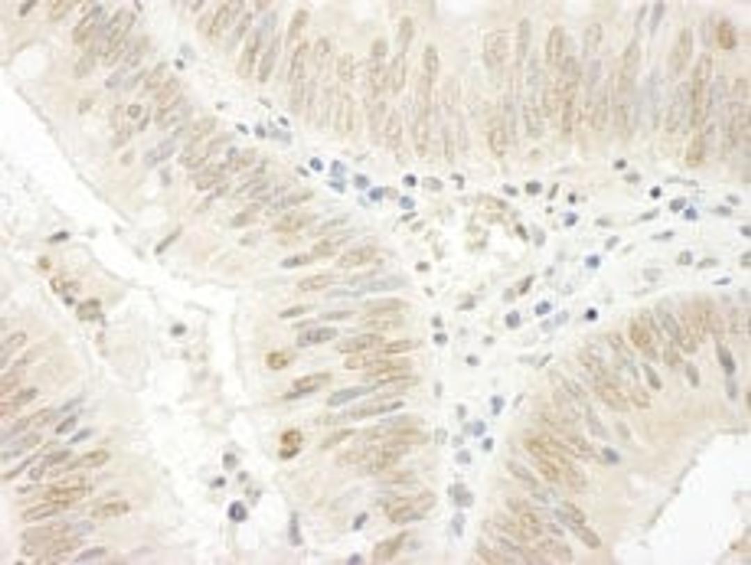 Detection of human NOPP140 by immunohistochemistry.