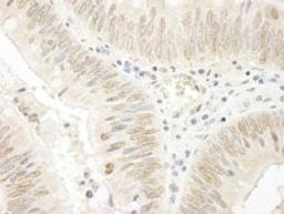 Detection of human NOPP140 by immunohistochemistry.