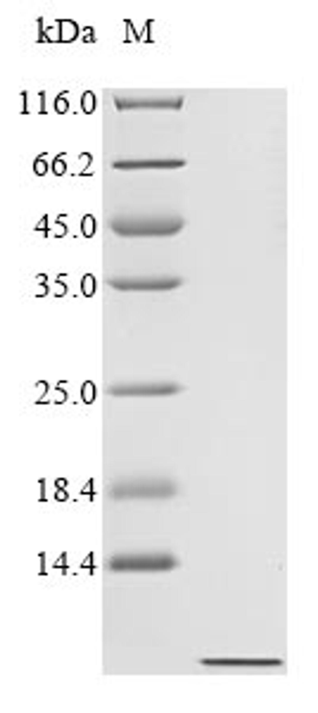 (Tris-Glycine gel) Discontinuous SDS-PAGE (reduced) with 5% enrichment gel and 15% separation gel.