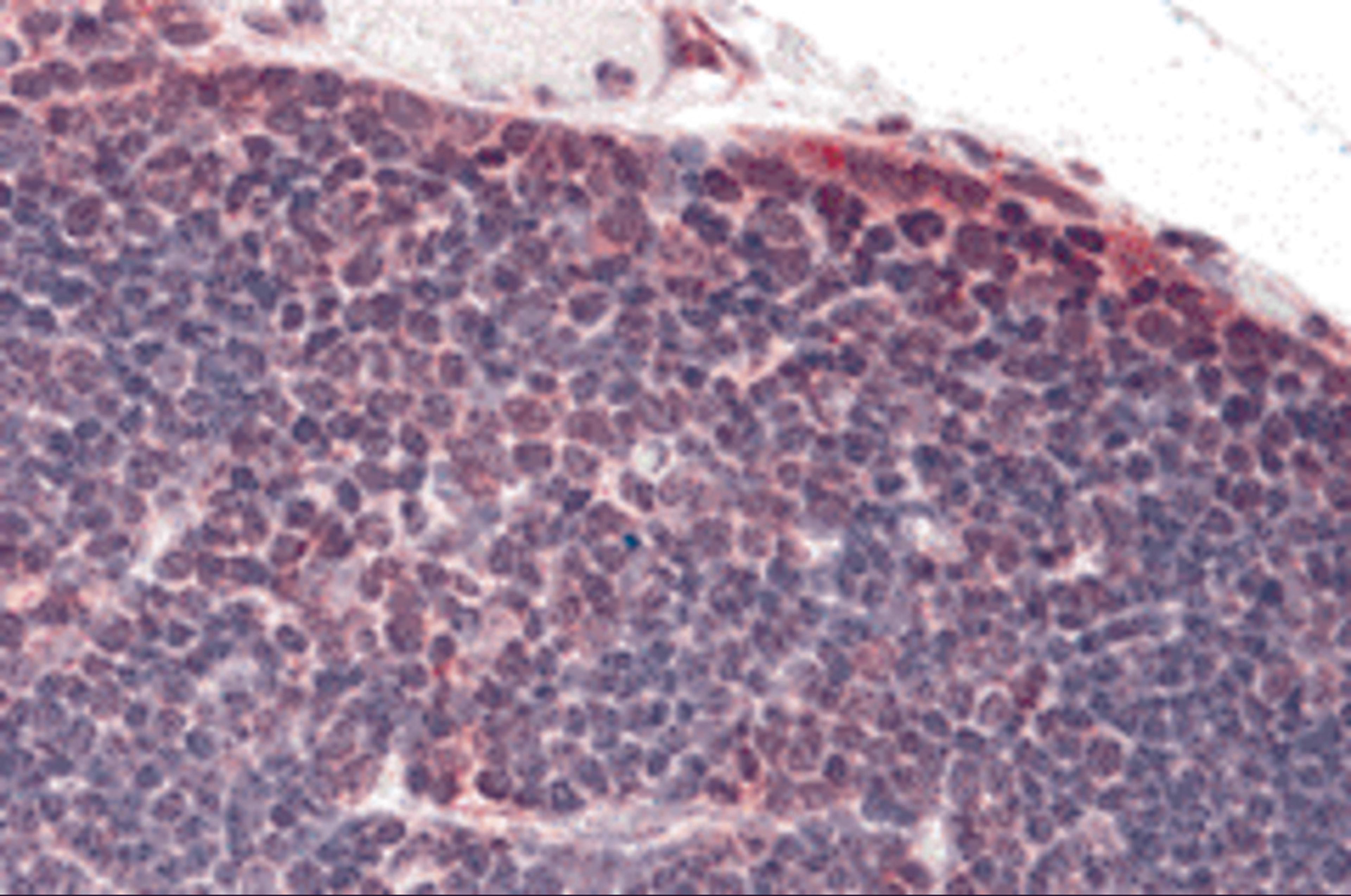 Immunohistochemistry of TLR8 in human thymus tissue with TLR8 antibody at 5 μg/mL.