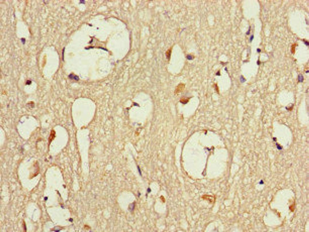 Immunohistochemistry of paraffin-embedded human brain tissue using CSB-PA819469LA01HU at dilution of 1:100