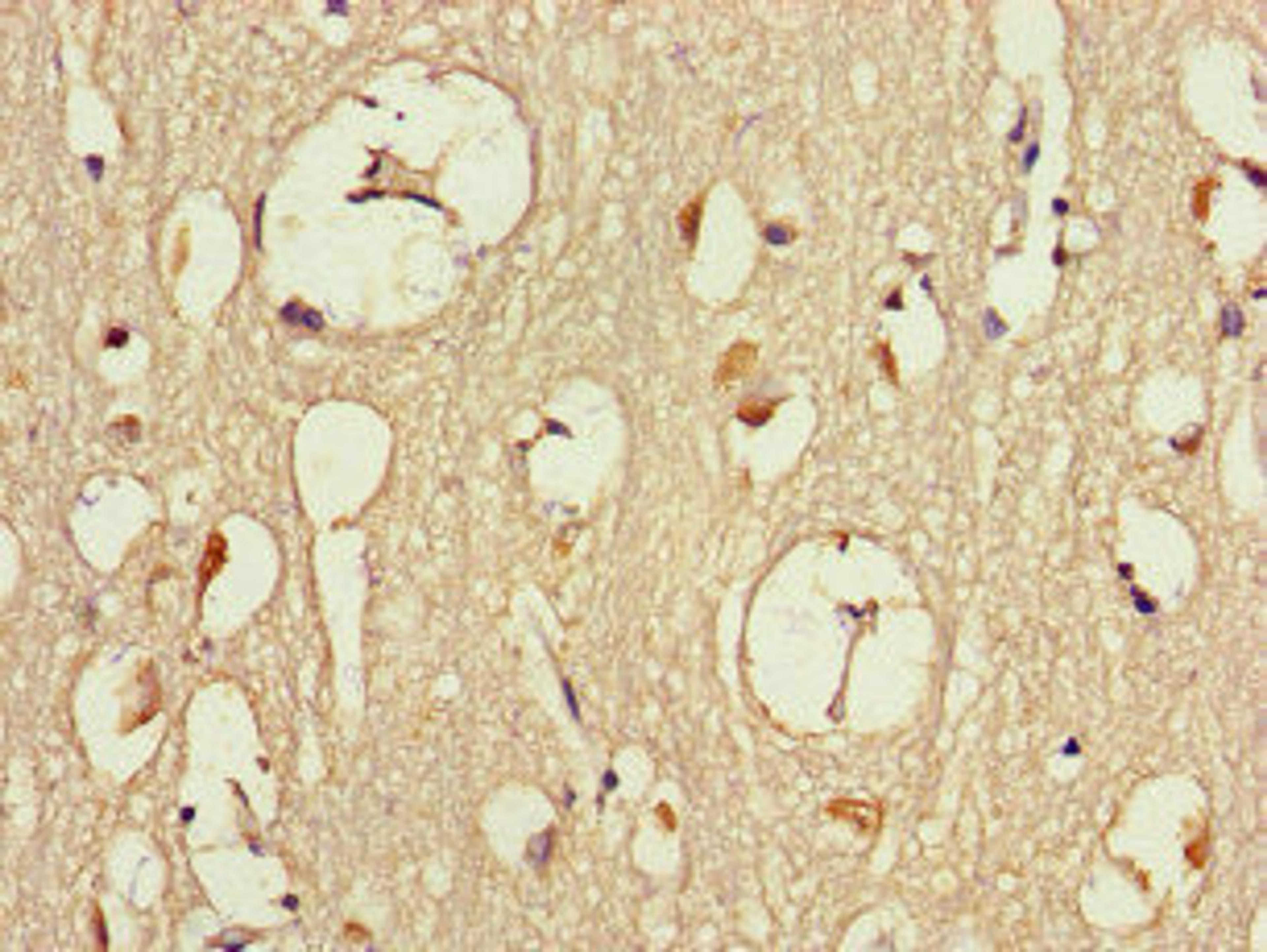 Immunohistochemistry of paraffin-embedded human brain tissue using CSB-PA819469LA01HU at dilution of 1:100