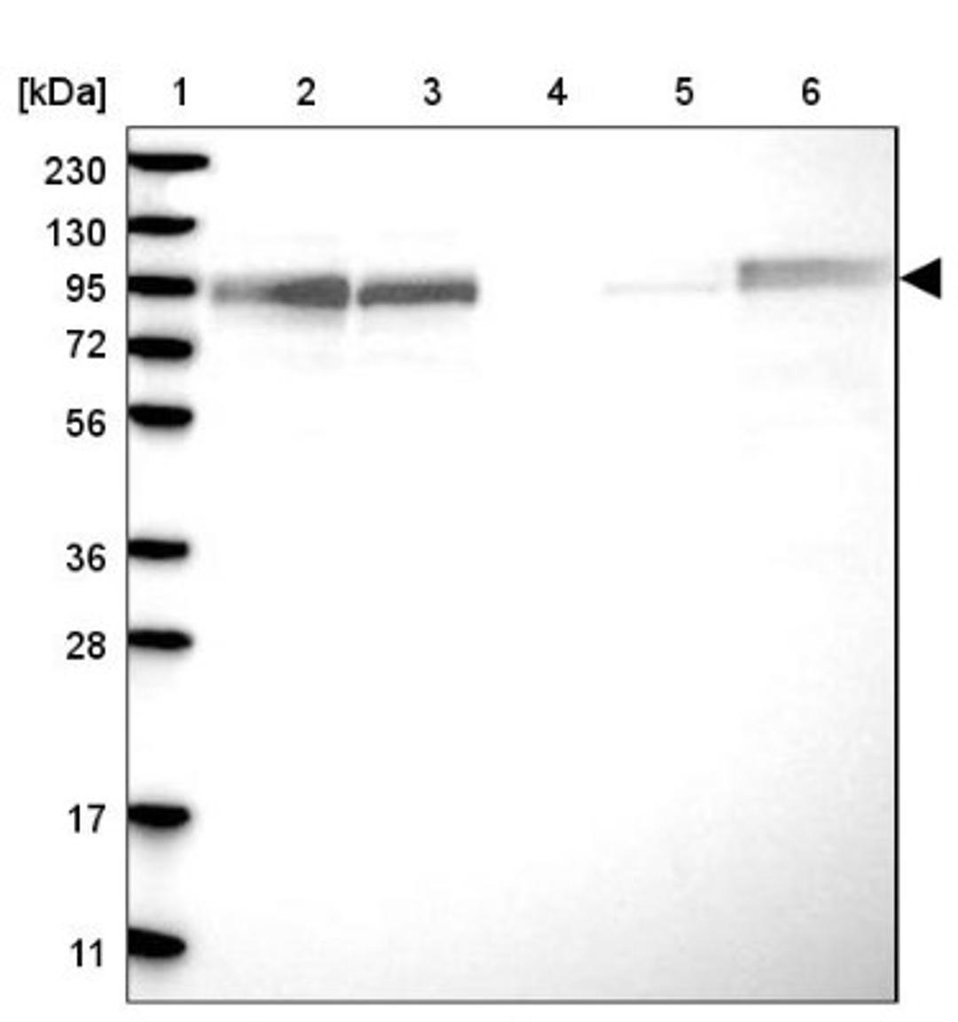 Western Blot: FAM129B Antibody [NBP1-88783] - Lane 1: Marker [kDa] 230, 130, 95, 72, 56, 36, 28, 17, 11<br/>Lane 2: Human cell line RT-4<br/>Lane 3: Human cell line U-251MG sp<br/>Lane 4: Human plasma (IgG/HSA depleted)<br/>Lane 5: Human liver tissue<br/>Lane 6: Human tonsil tissue