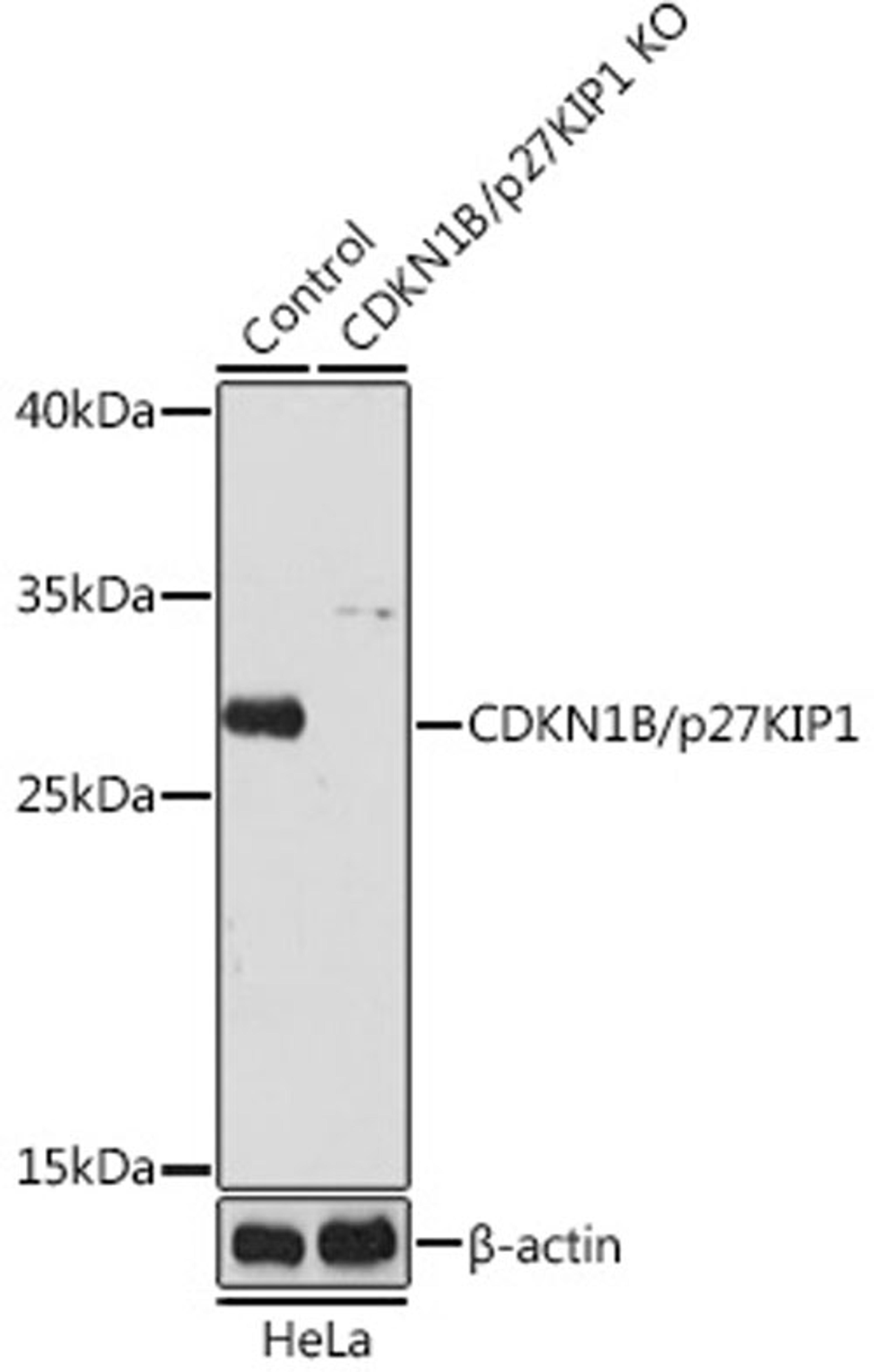 Western blot - CDKN1B/p27KIP1 antibody (A0290)