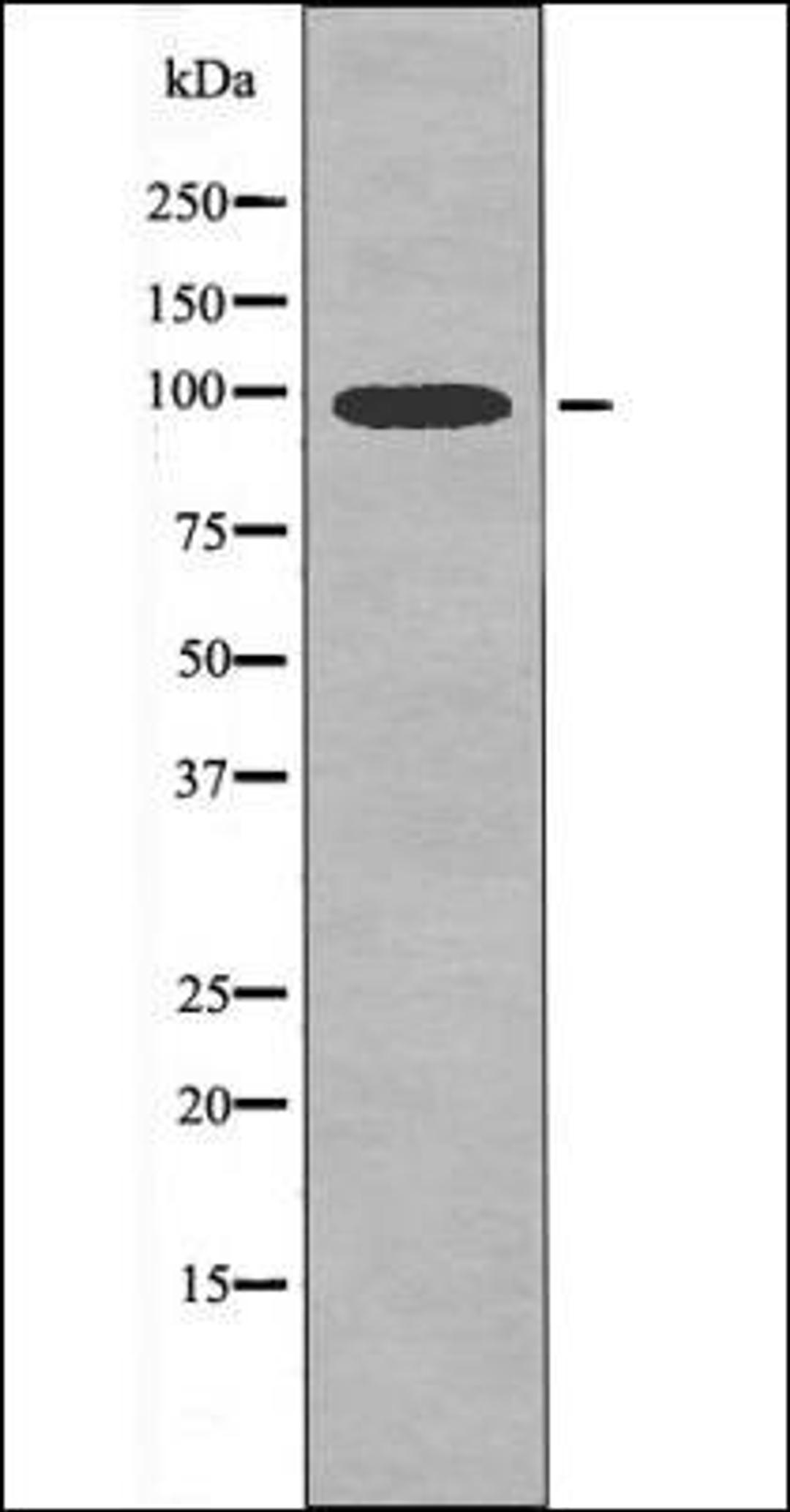 Western blot analysis of K562 whole cell lysates using MLK3 -Phospho-Thr277+Ser281- antibody