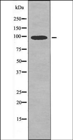 Western blot analysis of K562 whole cell lysates using MLK3 -Phospho-Thr277+Ser281- antibody