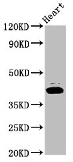 Western Blot. Positive WB detected in: Rat heart tissue. All lanes: NSDHL antibody at 7.2ug/ml. Secondary. Goat polyclonal to rabbit IgG at 1/50000 dilution. Predicted band size: 42 kDa. Observed band size: 42 kDa.