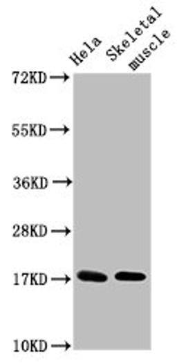 Western Blot. Positive WB detected in: Hela whole cell lysate, Rat skeletal muscle tissue. All lanes: UBE2D3 antibody at 4.8µg/ml. Secondary. Goat polyclonal to rabbit IgG at 1/50000 dilution. Predicted band size: 17 kDa. Observed band size: 17 kDa