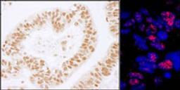 Detection of human PLRG1 by immunohistochemistry.