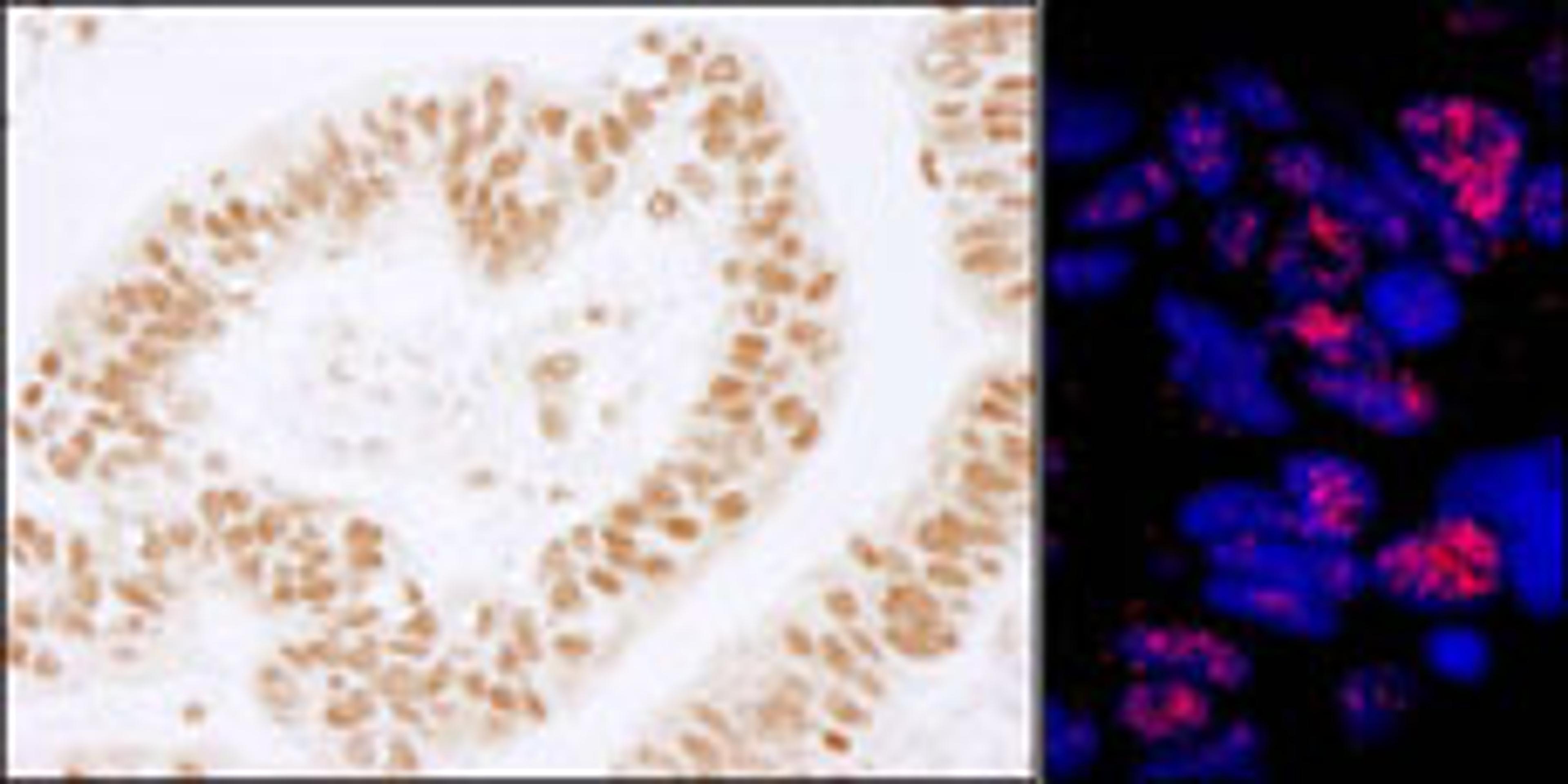 Detection of human PLRG1 by immunohistochemistry.