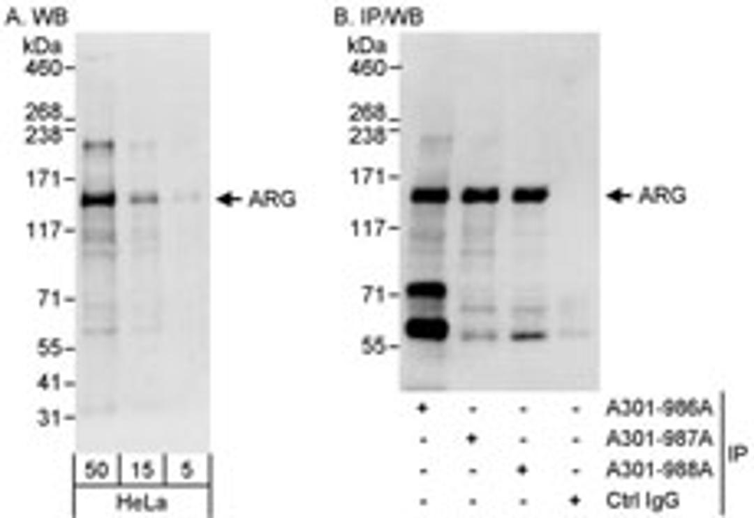 Detection of human ARG by western blot and immunoprecipitation.