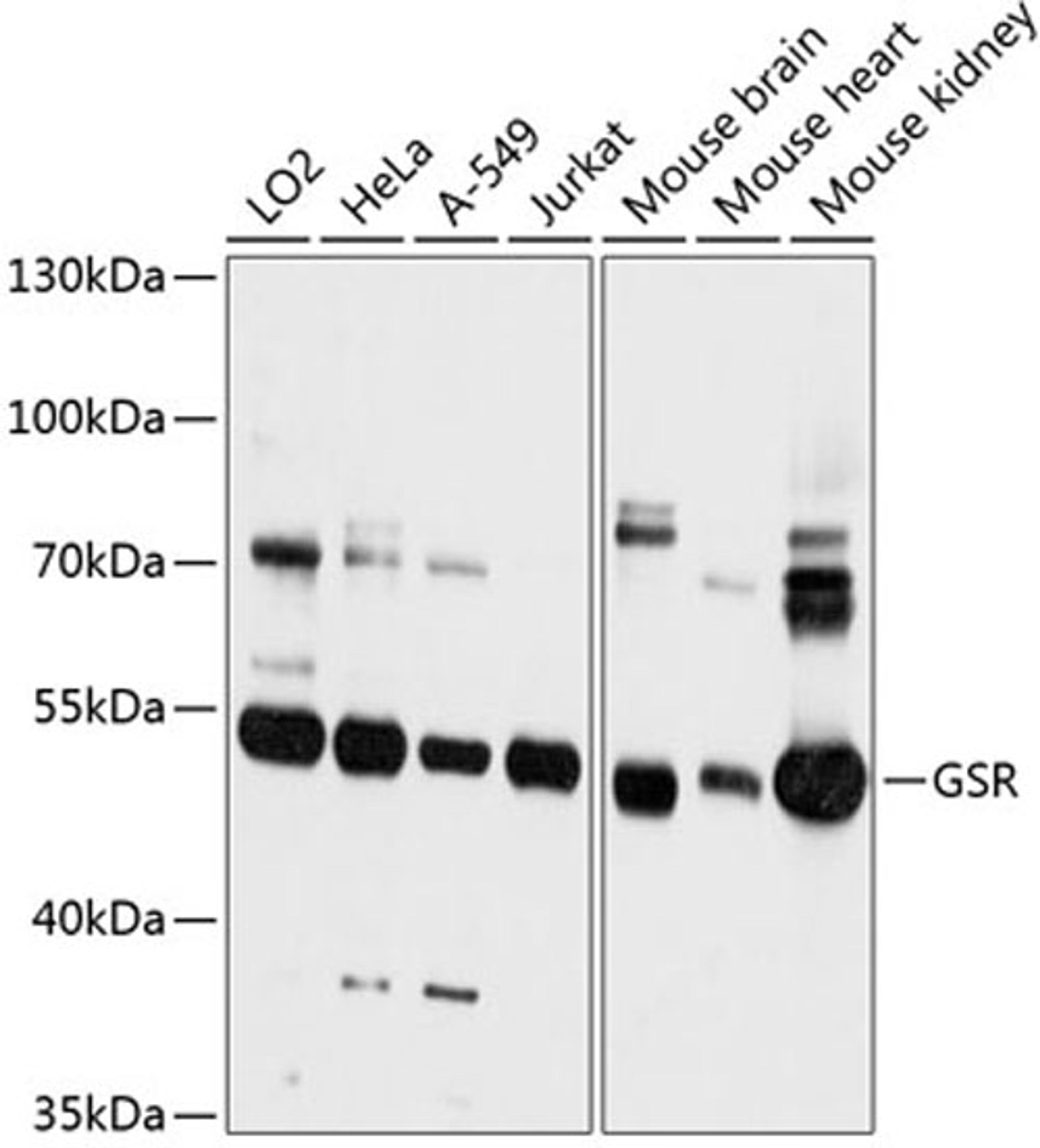 Western blot - GSR antibody (A12070)