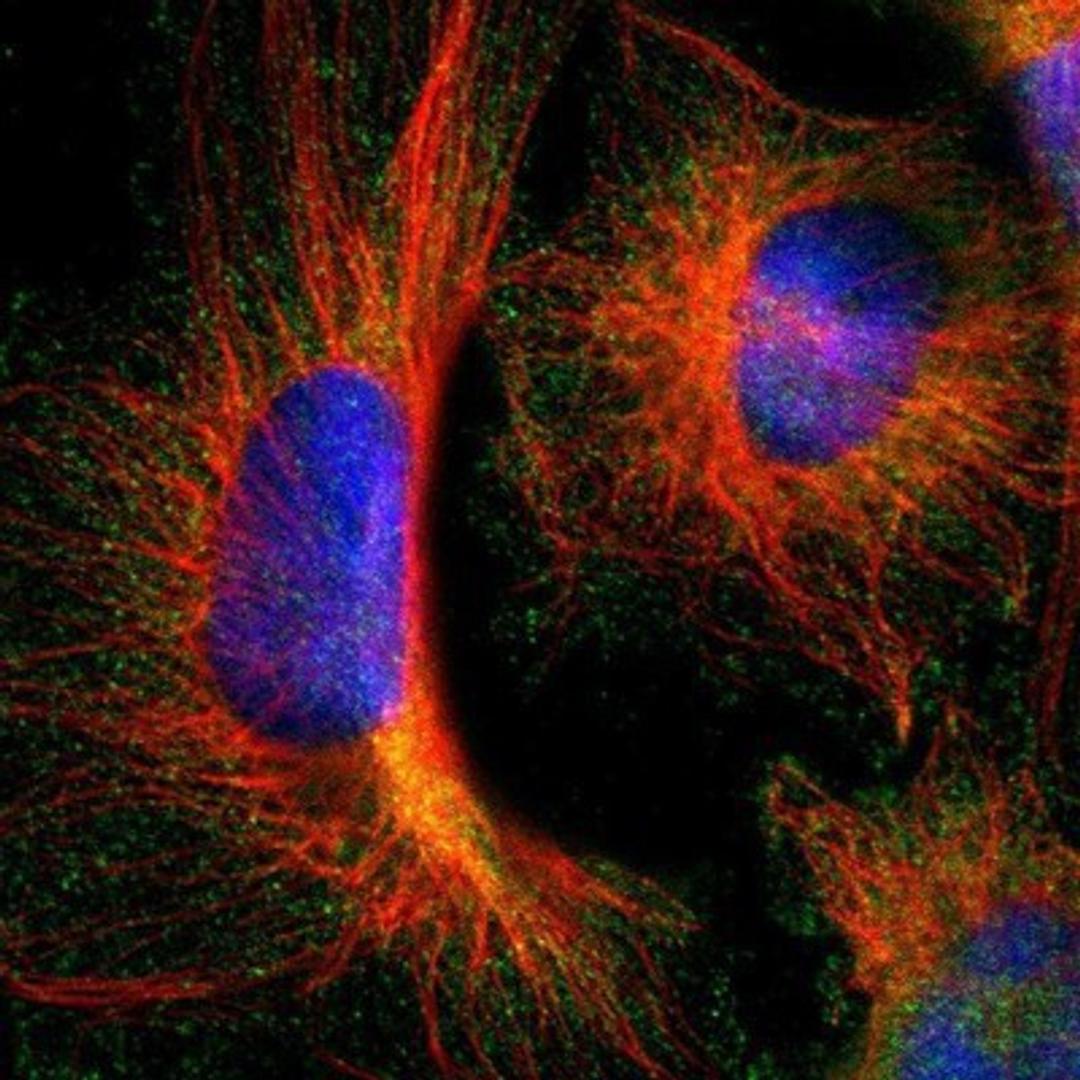 Immunocytochemistry/Immunofluorescence: ARA54 Antibody [NBP1-89021] - Staining of human cell line U-251MG shows positivity in cytoplasm.