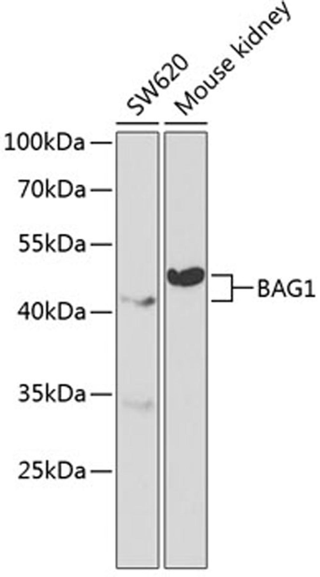 Western blot - BAG1 antibody (A1104)