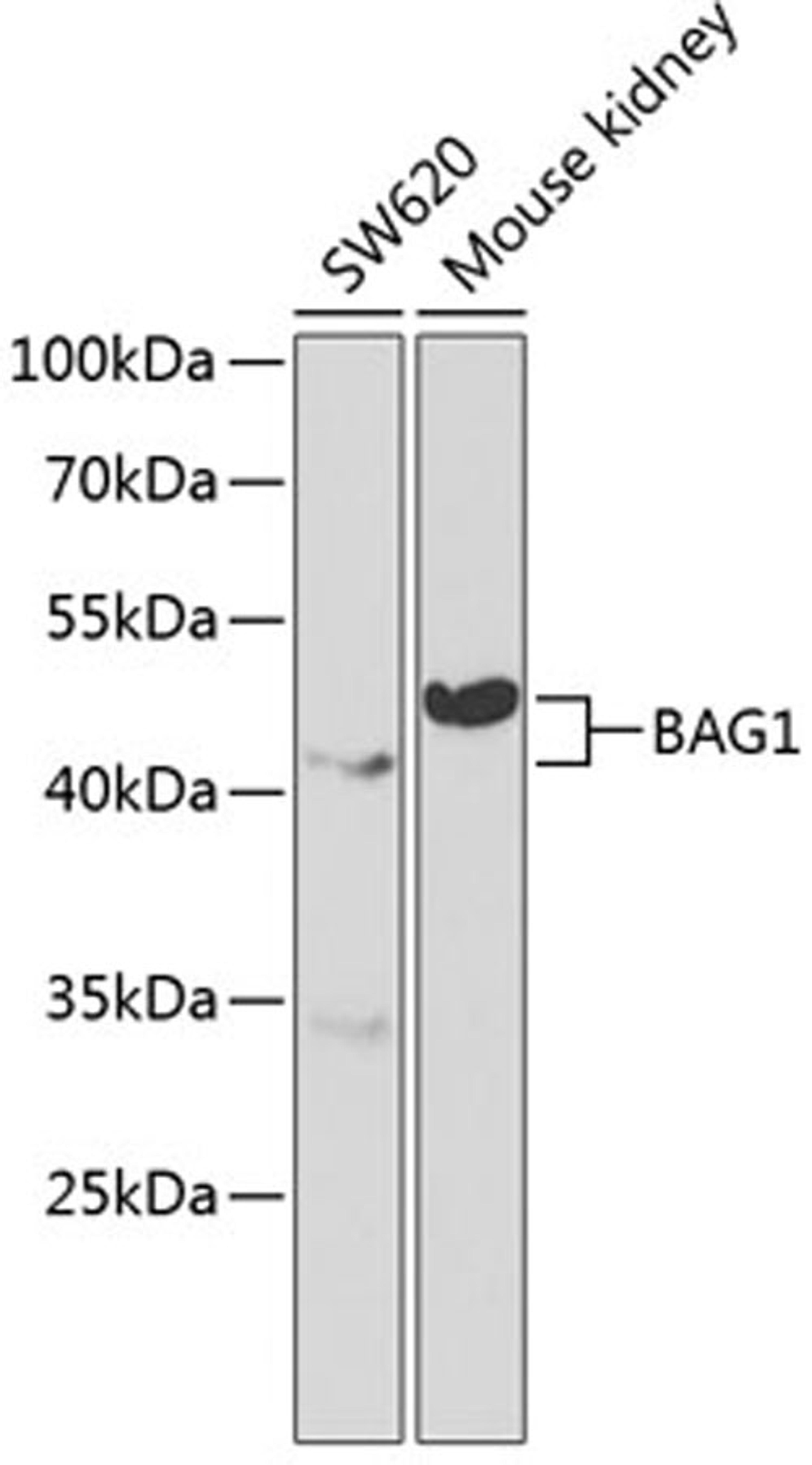 Western blot - BAG1 antibody (A1104)