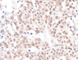 Detection of human Caf1p150 by immunohistochemistry.