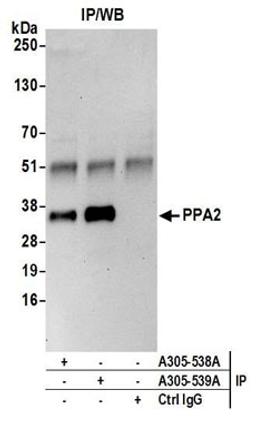 Detection of human PPA2 by western blot of immunoprecipitates.