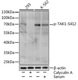 Western blot - Phospho-TAK1-S412 Rabbit pAb (AP0071)