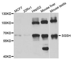 Western blot analysis of extract of various cells using SGSH antibody