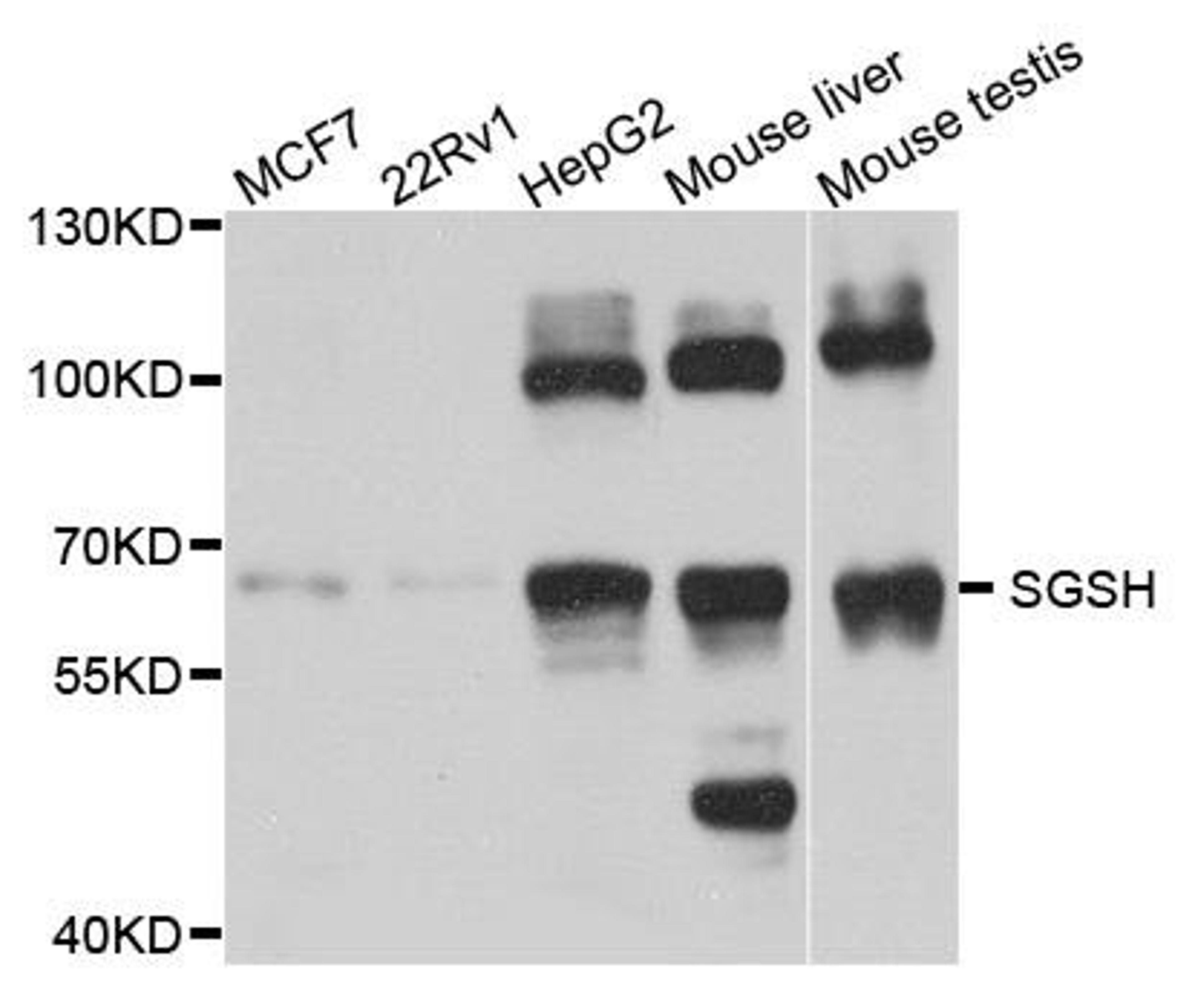 Western blot analysis of extract of various cells using SGSH antibody