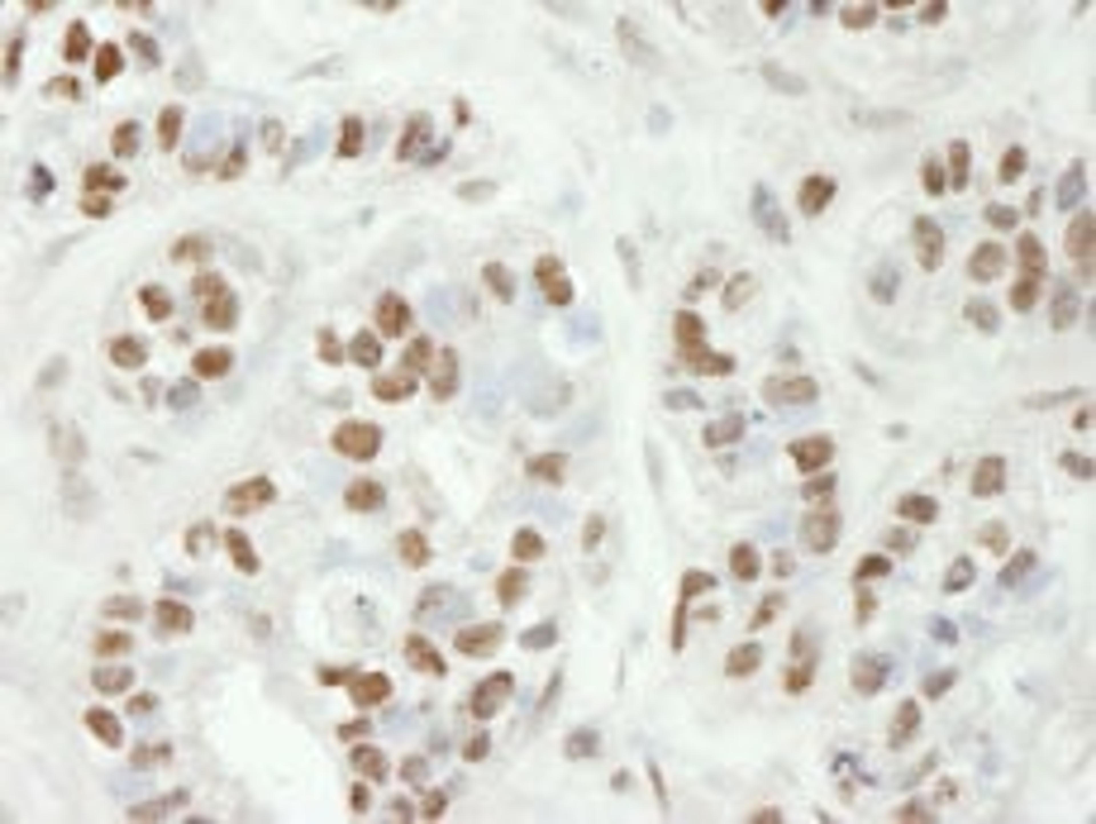 Detection of human ZC3H11A by immunohistochemistry.