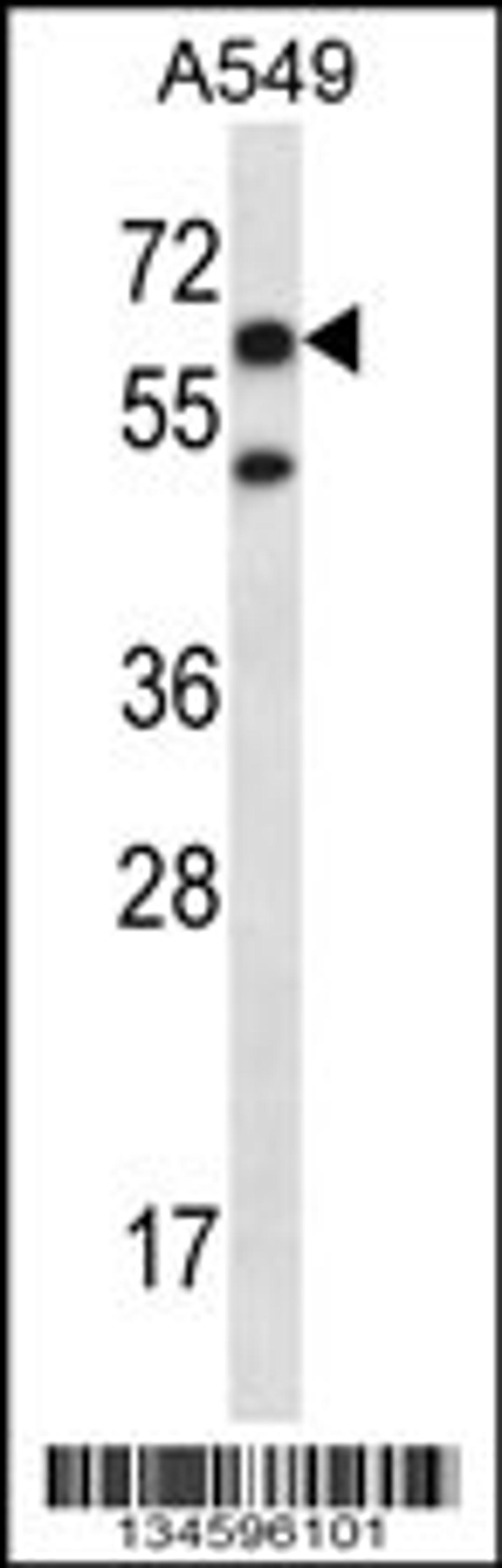 Western blot analysis in A549 cell line lysates (35ug/lane).