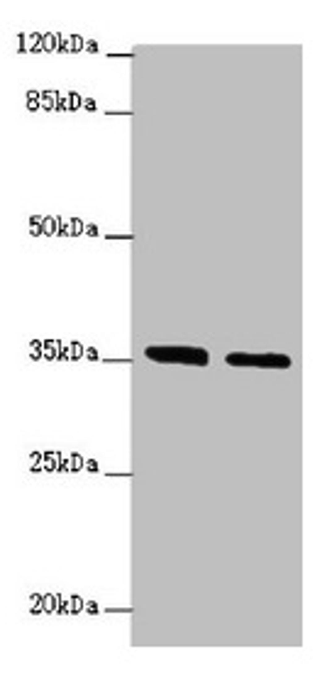 Western blot. All lanes: OSGEP antibody at 2.04µg/ml. Lane 1: Jurkat whole cell lysate. Lane 2: PC-3 whole cell lysate. Secondary. Goat polyclonal to rabbit IgG at 1/10000 dilution. Predicted band size: 36 kDa. Observed band size: 36 kDa