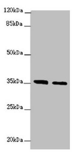 Western blot. All lanes: OSGEP antibody at 2.04µg/ml. Lane 1: Jurkat whole cell lysate. Lane 2: PC-3 whole cell lysate. Secondary. Goat polyclonal to rabbit IgG at 1/10000 dilution. Predicted band size: 36 kDa. Observed band size: 36 kDa