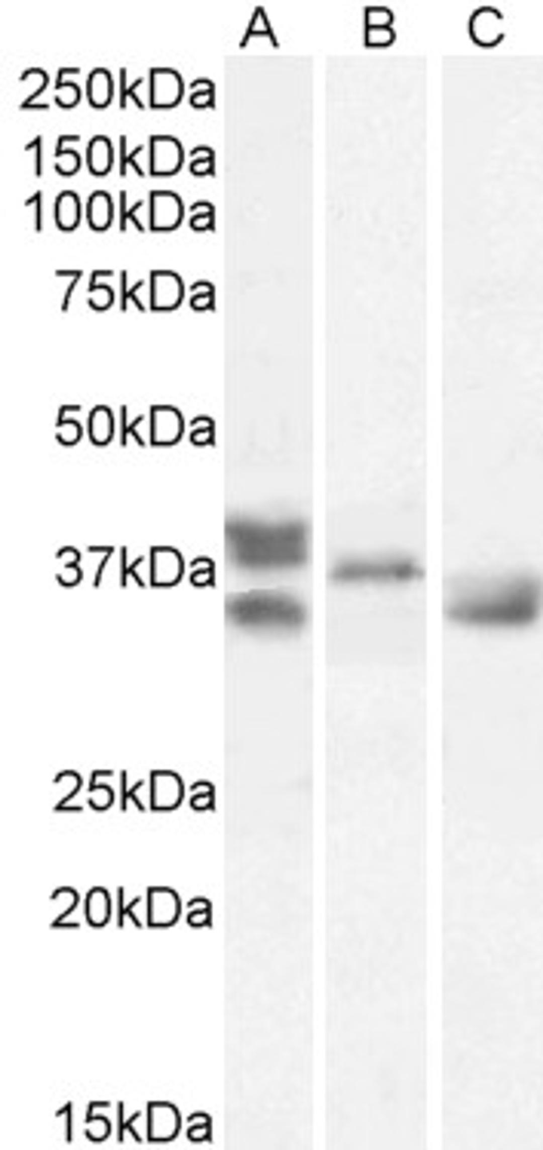 46-278 (1ug/ml) staining of Human Heart (A), Mouse Heart (B), Rat Heart (C) lysates (35ug protein in RIPA buffer). Primary incubation was 1 hour. Detected by chemiluminescence..