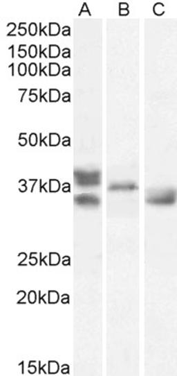 46-278 (1ug/ml) staining of Human Heart (A), Mouse Heart (B), Rat Heart (C) lysates (35ug protein in RIPA buffer). Primary incubation was 1 hour. Detected by chemiluminescence..