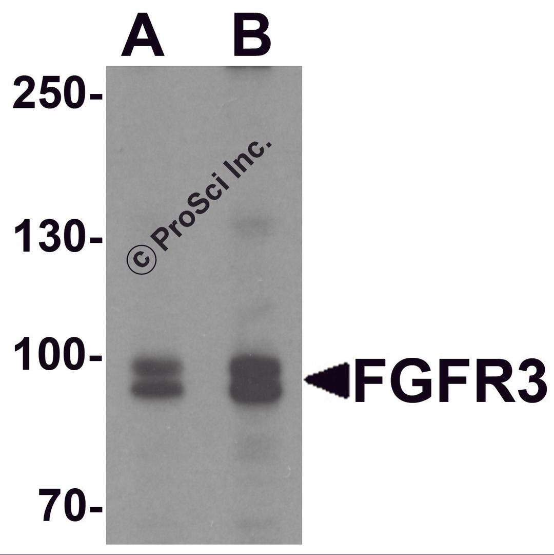 Western blot analysis of FGFR3 in SK-N-SH cell lysate with FGFR3 antibody at (A) 0.5 and (B) 1 μg/mL.