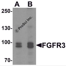 Western blot analysis of FGFR3 in SK-N-SH cell lysate with FGFR3 antibody at (A) 0.5 and (B) 1 μg/mL.