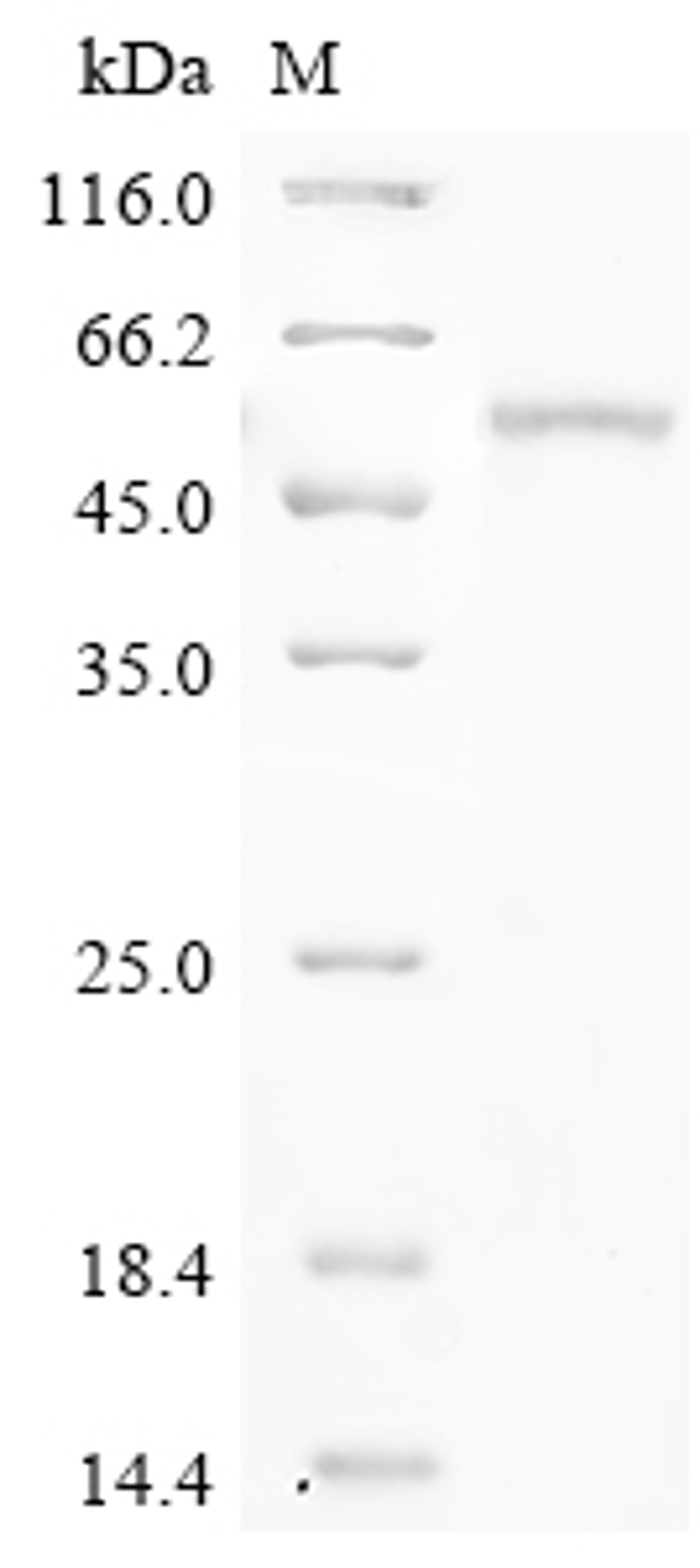 (Tris-Glycine gel) Discontinuous SDS-PAGE (reduced) with 5% enrichment gel and 15% separation gel.
