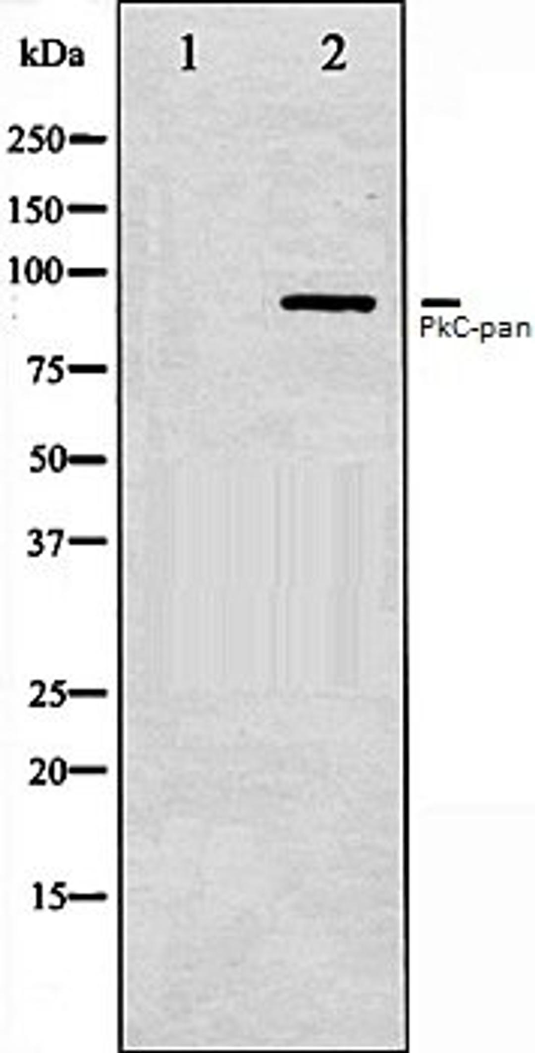 Western blot analysis of NIH-3T3 whole cell lysates using PKC-pan antibody, The lane on the left is treated with the antigen-specific peptide.