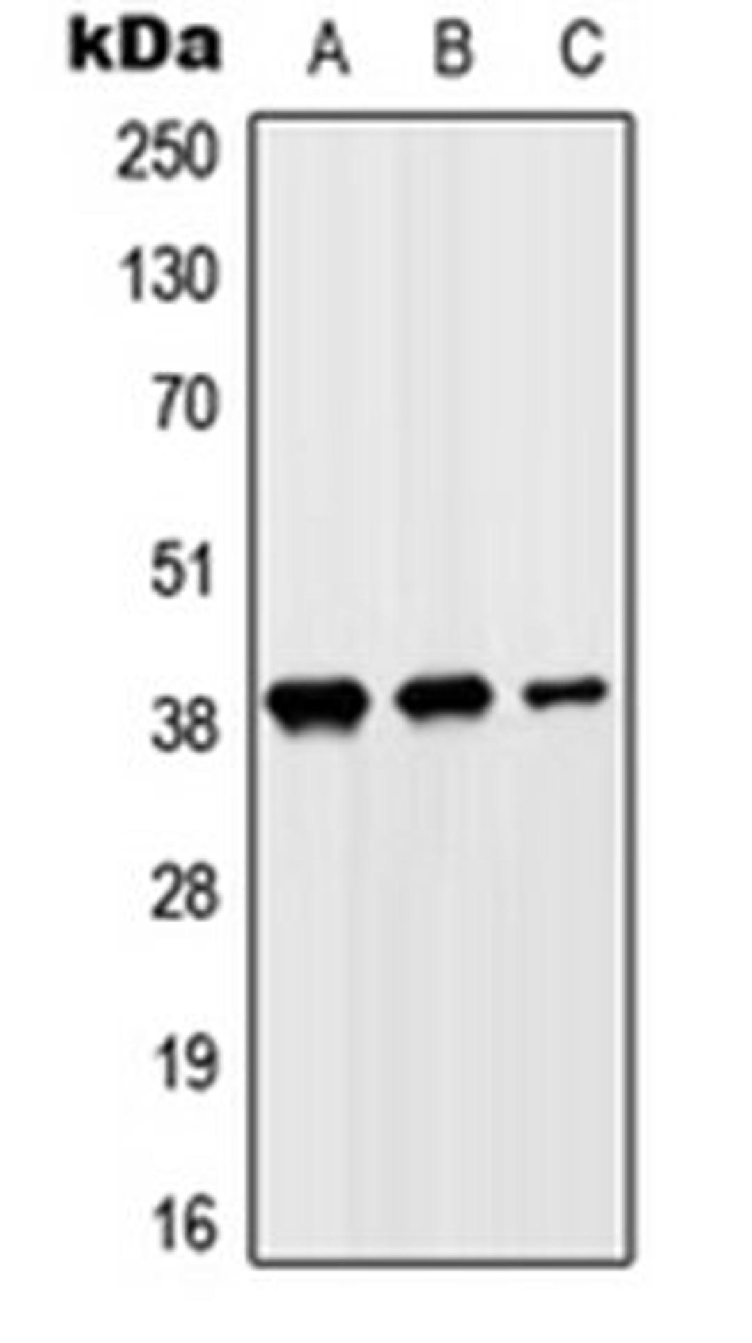 Western blot analysis of HeLa (Lane 1), HepG2 (Lane 2), H9C2 (Lane 3) whole cell lysates using SLC10A7 antibody