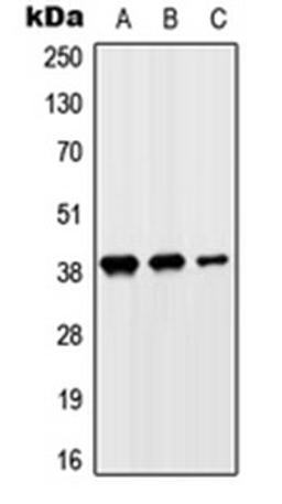 Western blot analysis of HeLa (Lane 1), HepG2 (Lane 2), H9C2 (Lane 3) whole cell lysates using SLC10A7 antibody