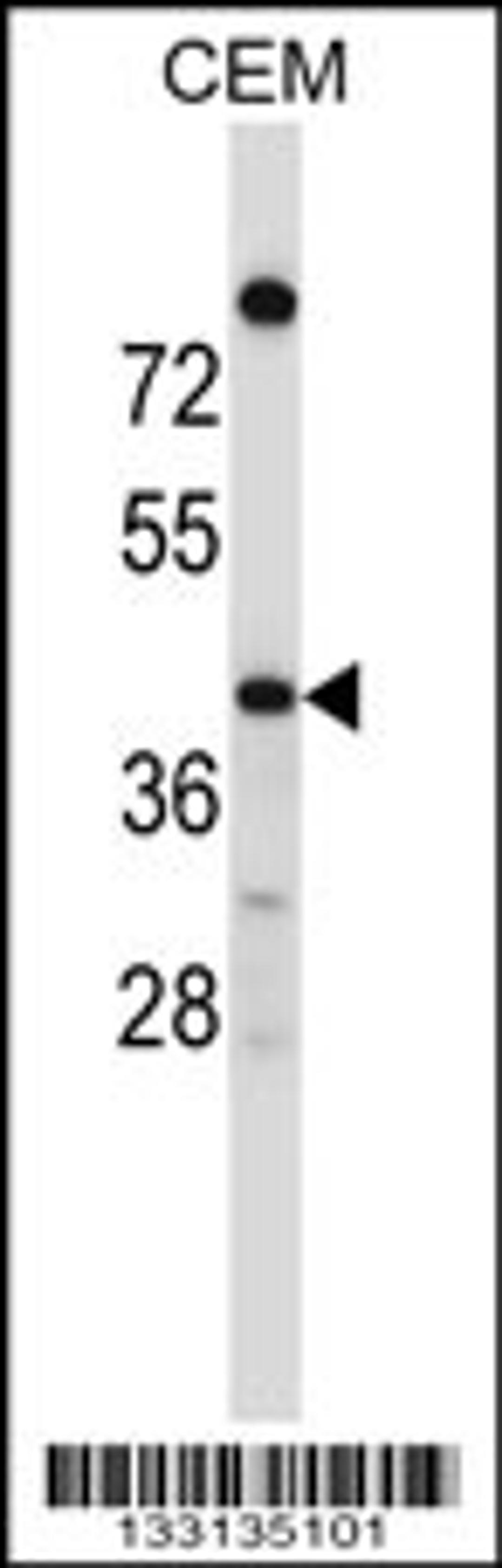 Western blot analysis in CEM cell line lysates (35ug/lane).