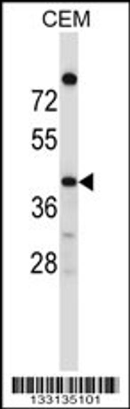 Western blot analysis in CEM cell line lysates (35ug/lane).