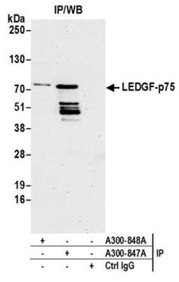 Detection of human LEDGF/p75 by western blot of immunoprecipitates.