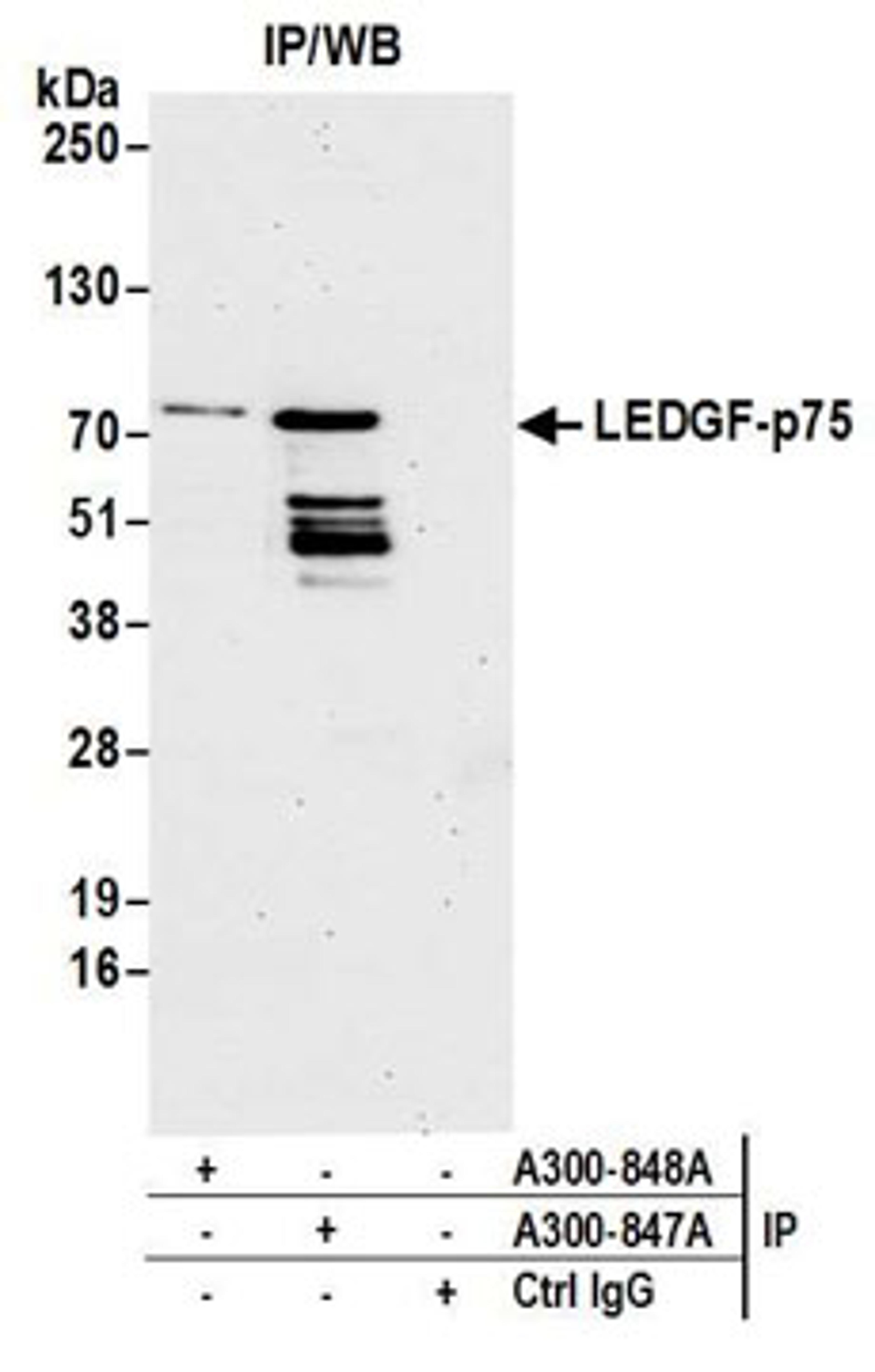 Detection of human LEDGF/p75 by western blot of immunoprecipitates.