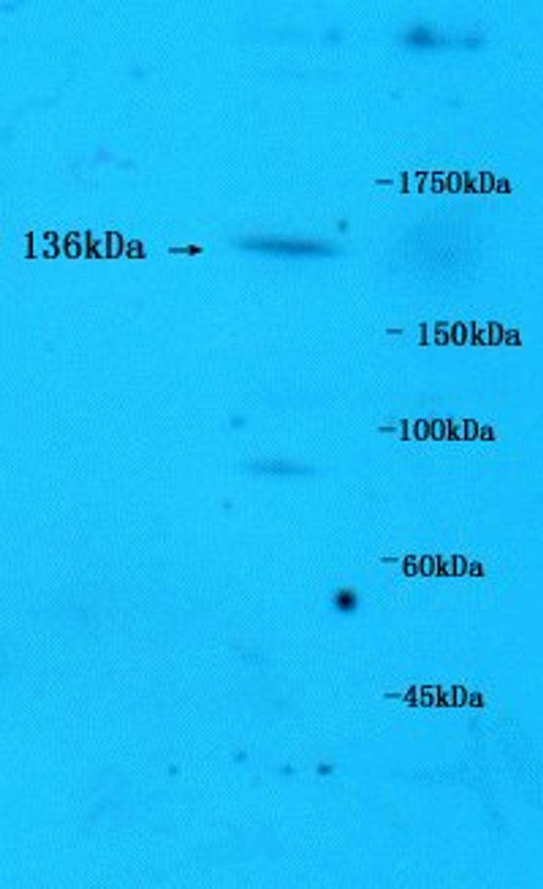 Western blot of mouse brain tissue using PLC beta3 (phospho-Ser1105) antibody.