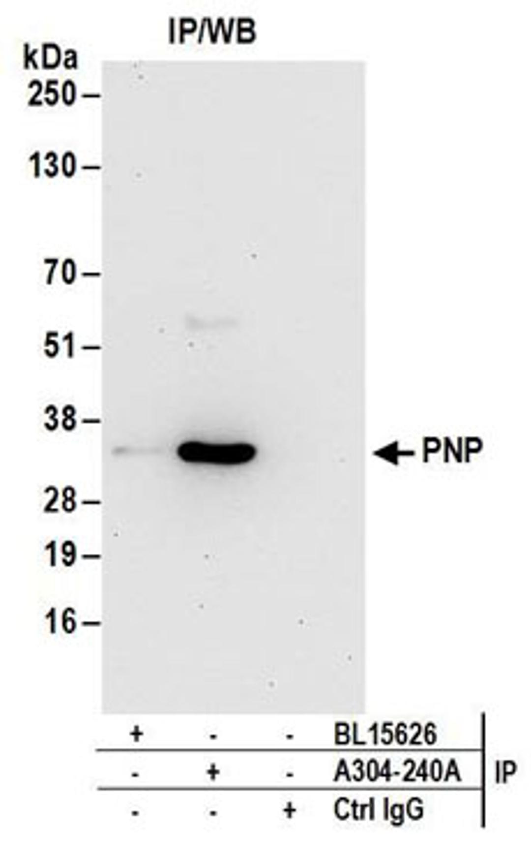 Detection of human PNP by western blot of immunoprecipitates.