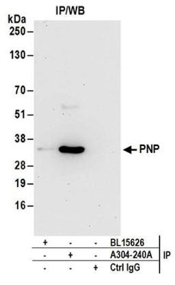 Detection of human PNP by western blot of immunoprecipitates.