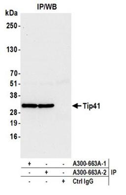 Detection of human Tip41 by western blot of immunoprecipitates.