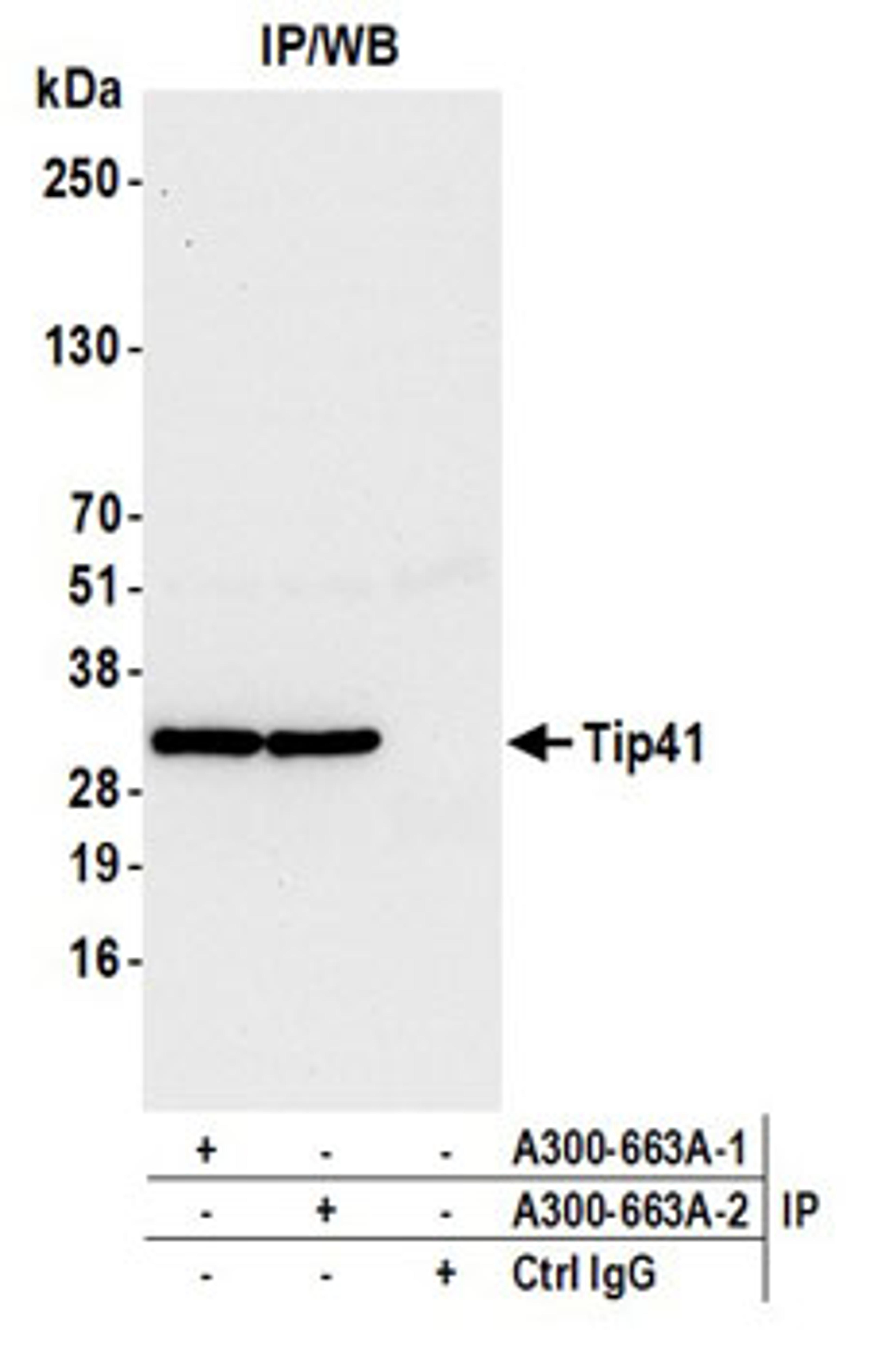 Detection of human Tip41 by western blot of immunoprecipitates.