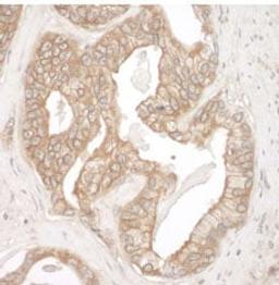 Detection of human Cortactin by immunohistochemistry.