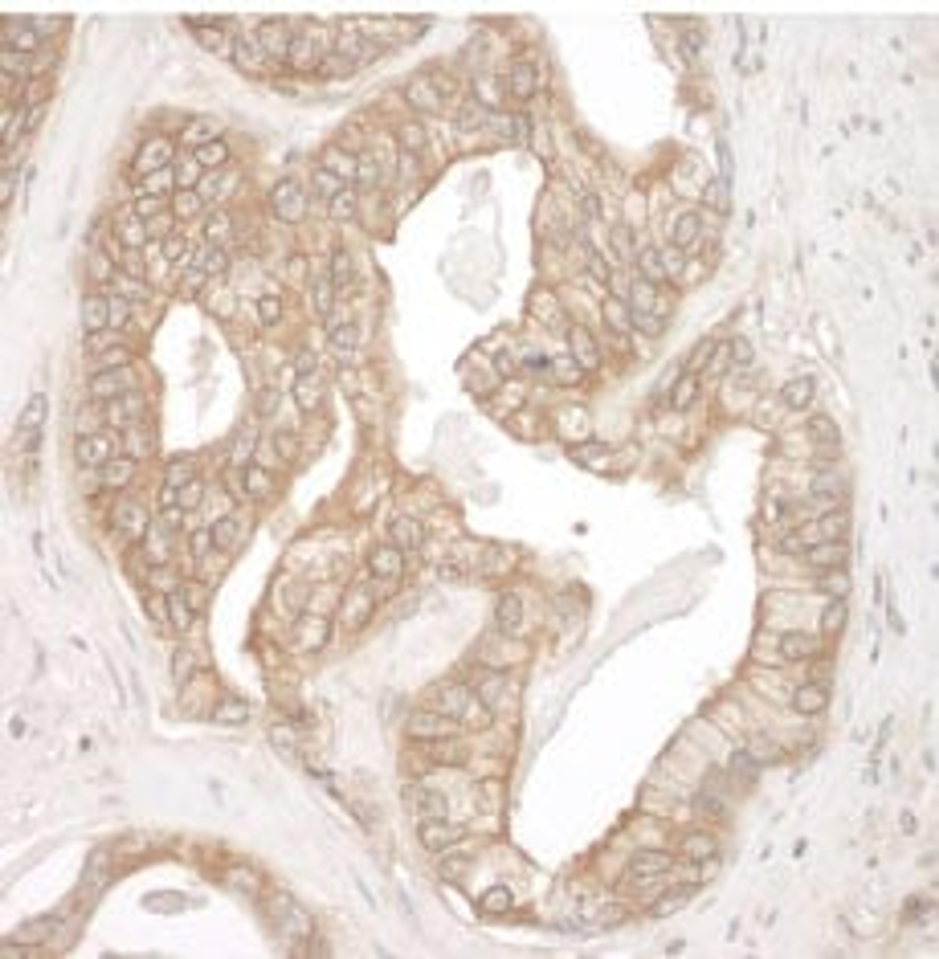 Detection of human Cortactin by immunohistochemistry.