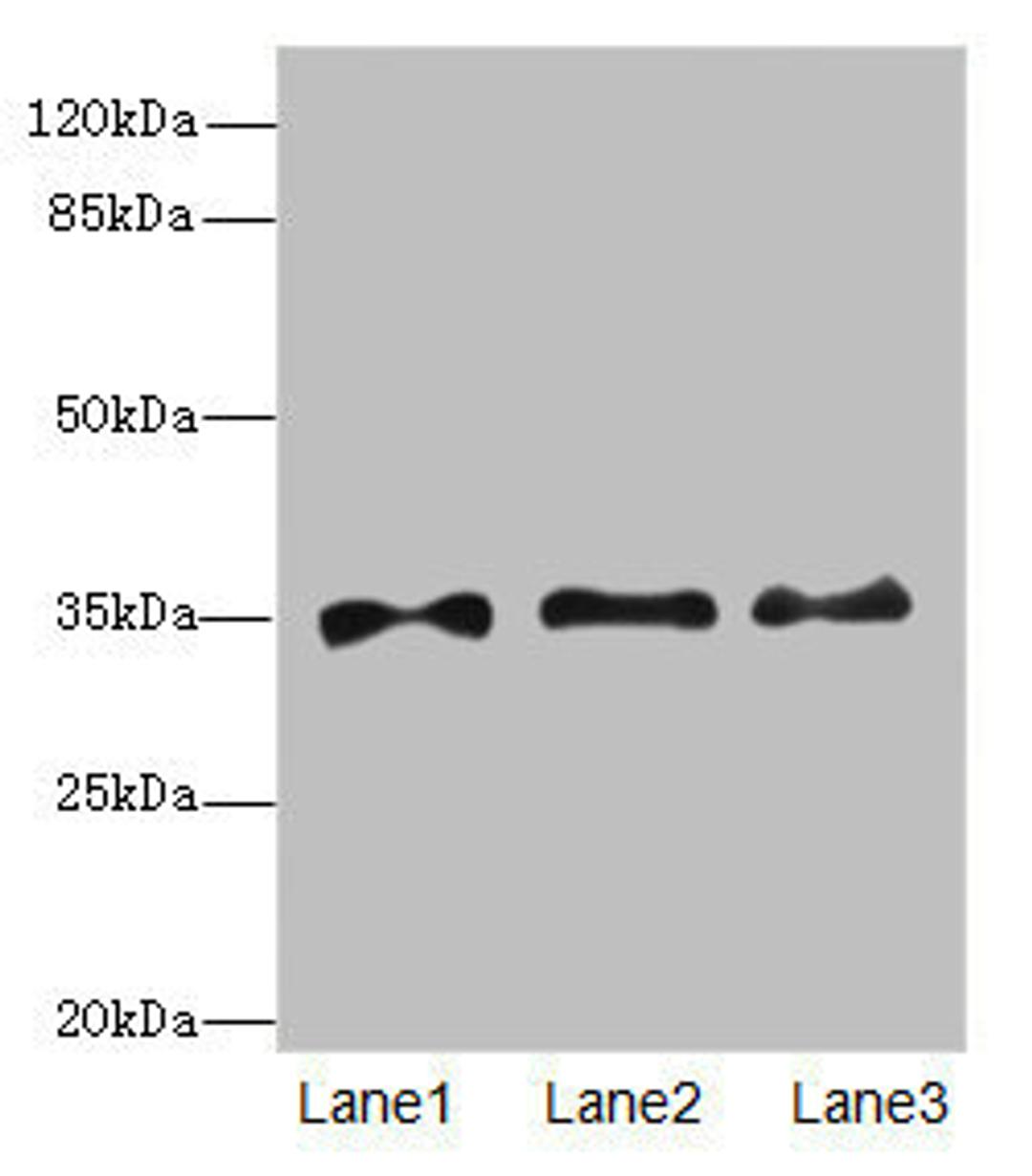 Western blot. All lanes: PRPS1antibody at 6.28ug/ml. Lane 1: HepG2 whole cell lysate. Lane 2: Jurkat whole cell lysate. Lane 3: 293T whole cell lysate. Secondary. Goat polyclonal to rabbit IgG at 1/10000 dilution. Predicted band size: 35, 28 kDa. Observed band size: 35 kDa. 