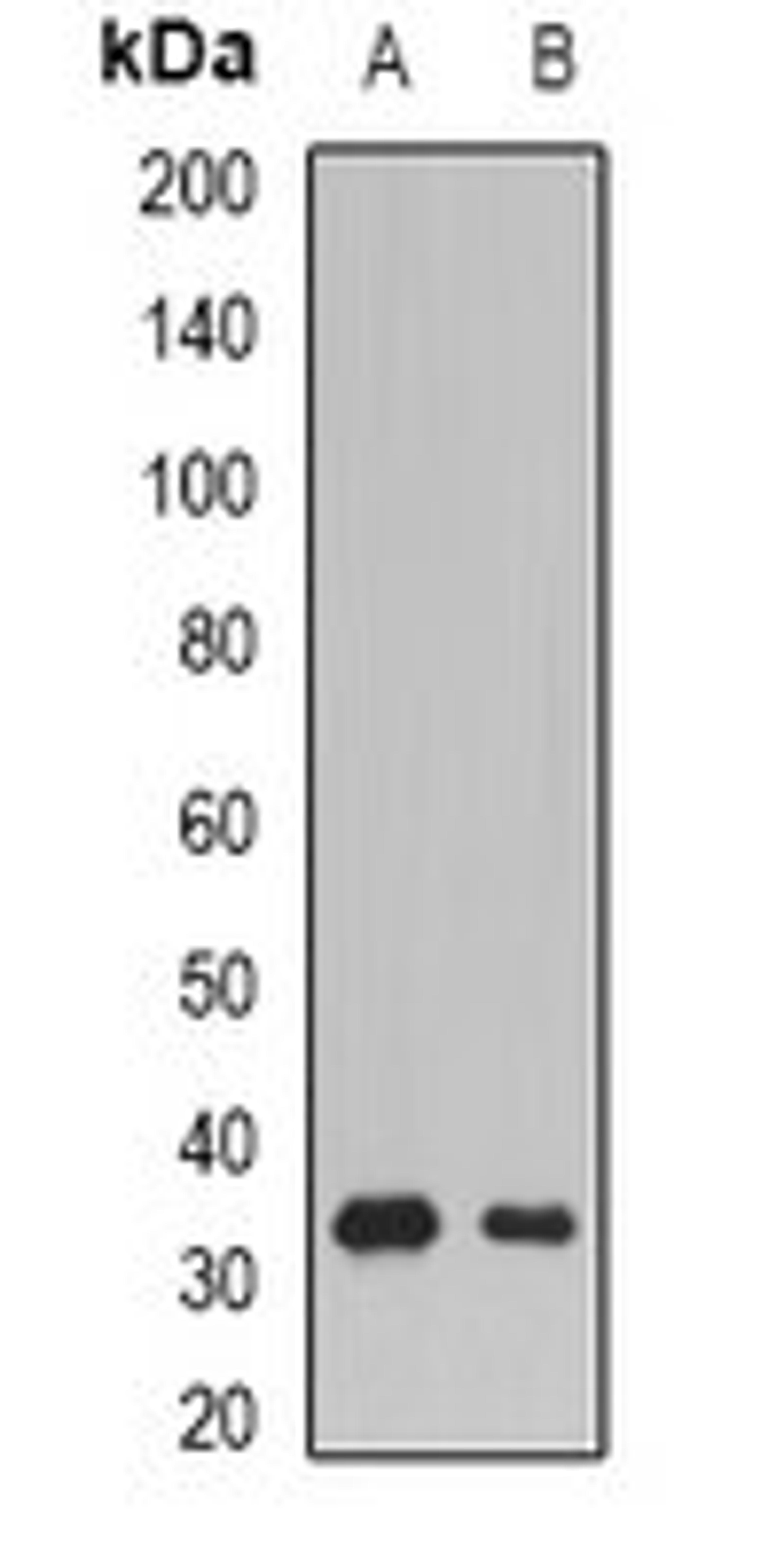 Western blot analysis of Raji (Lane1), mouse skeletal muscle (Lane2) whole cell lysates using SSX5 antibody