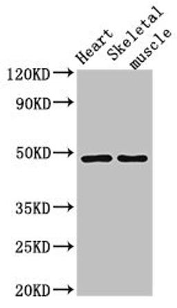 Western Blot. Positive WB detected in: Mouse heart tissue, Mouse skeletal muscle tissue. All lanes: CD36 antibody at 2ug/ml. Secondary. Goat polyclonal to rabbit IgG at 1/50000 dilution. Predicted band size: 54, 33, 49, 47 kDa. Observed band size: 49 kDa. 